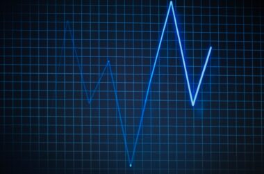 A blue line graph on a dark background showing fluctuations over a grid.